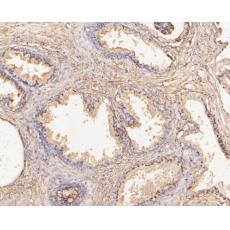 Anti-SLFN12 antibody