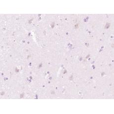 Anti-CH25H antibody