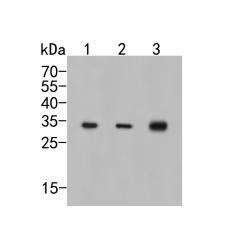 Anti-CAPZB antibody