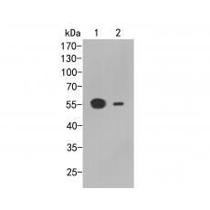 Anti-FCGRT antibody