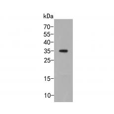 Anti-TMEM119 antibody