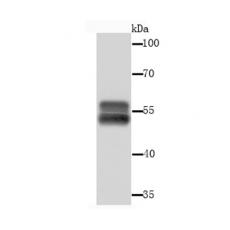 Anti-Cytokeratin 13 antibody