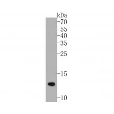 Anti-COX5B antibody