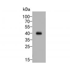 Anti-FCGRT antibody