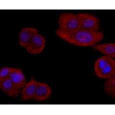 Anti-Ferritin antibody