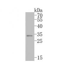 Anti-NAT1 antibody