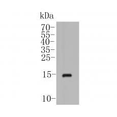 Anti-POLR2H antibody