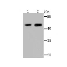 Anti-Osteoprotegerin antibody