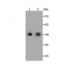 Anti-ASS1 antibody