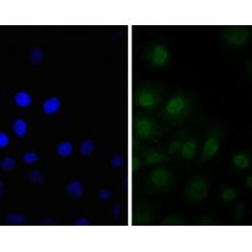 Anti-SSB antibody