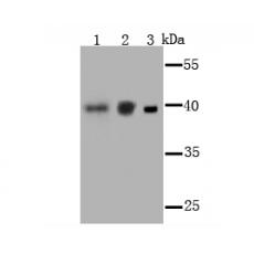 Anti-PCBP1 antibody