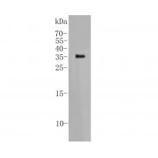 Anti-CD95 antibody