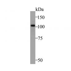 Anti-ZHX2 antibody