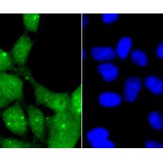 Anti-Glucocorticoid Receptor alpha antibody