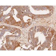 Anti-GADD34 antibody