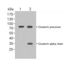 Anti-Clusterin antibody