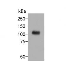 Anti-CBL antibody