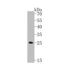 Anti-TREM2 antibody