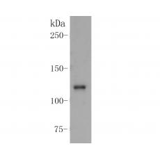 Anti-CD163 antibody