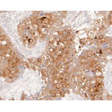 Anti-Muc1 antibody