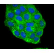 Anti-Jagged 1 antibody