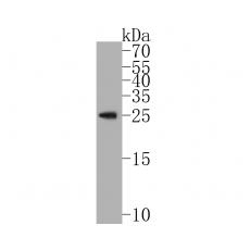Anti-RAB27B antibody