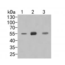 Anti-GPCR RDC1/CXCR-7 antibody