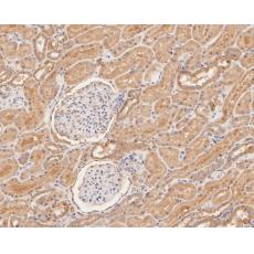 Anti-GBP2 antibody