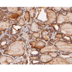 Anti-MDM2 antibody