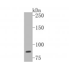 Anti-WDR70 antibody