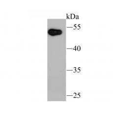 Anti-UBE1C antibody