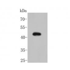 Anti-MSR1 antibody