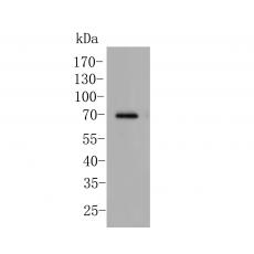 Anti-CDK5RAP3 antibody