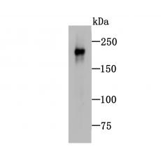 Anti-Neurofilament antibody