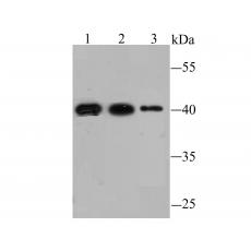 Anti-FBXL2 antibody