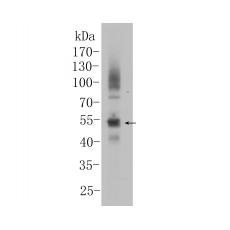 Anti-Pax8 antibody