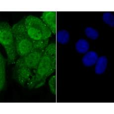 Anti-Progesterone receptor antibody