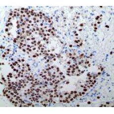 Anti-OCT-4 antibody