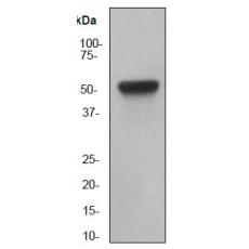 Anti-Cytokeratin 8 antibody