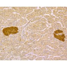 Anti-PGP9.5 antibody