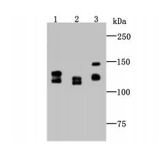 Anti-DDB1 antibody