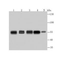 Anti-G6PD antibody