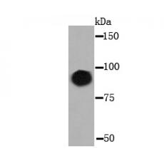 Anti-VCAM1 antibody