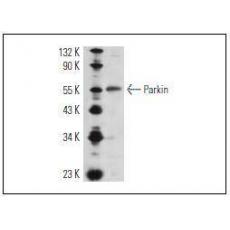 Anti-Parkin antibody