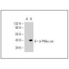 Anti-Phospho-PKA C (Thr198) antibody