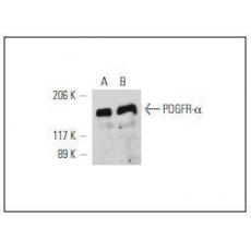 Anti-PDGF Receptor alpha antibody