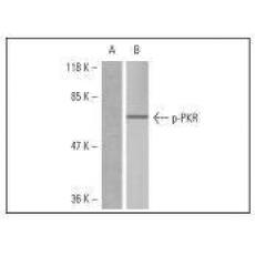 Anti-Phospho-PKR (Thr446) antibody