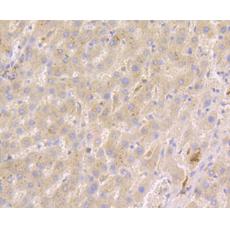Anti-LGR5/GPR49 antibody