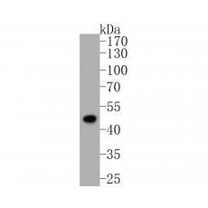 Anti-FH antibody