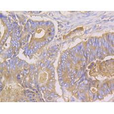 Anti-CEACAM6 antibody